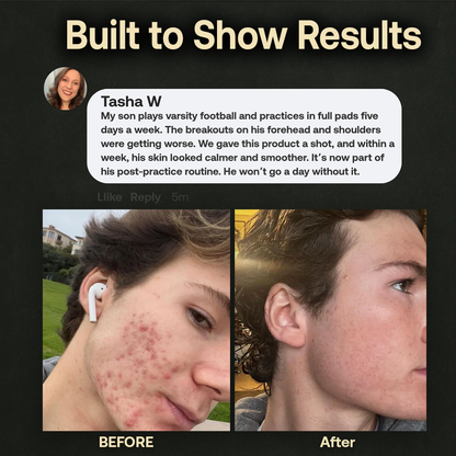 Flxbryte Athlete-Grade Balm
